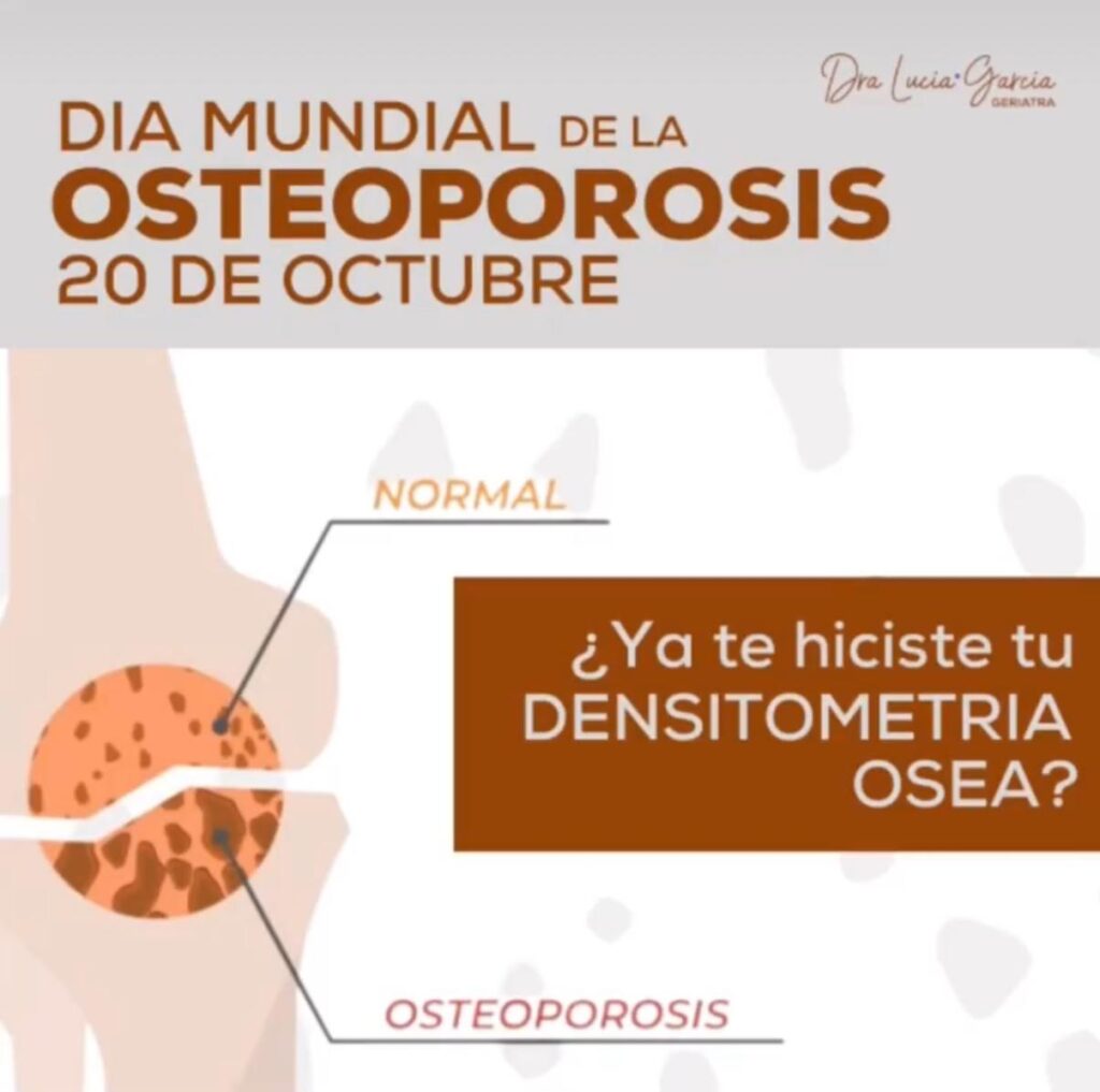 Día Mundial de la Osteoporosis – 20 de octubre